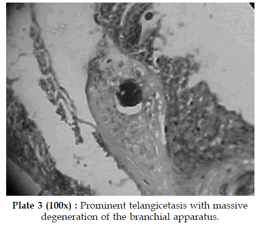 icontrolpollution-Prominent-telangicetasis