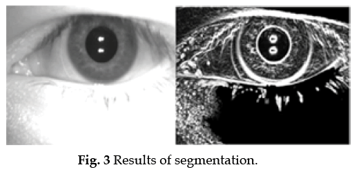 icontrolpollution-Results-segmentation