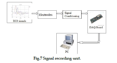 icontrolpollution-signal-recording